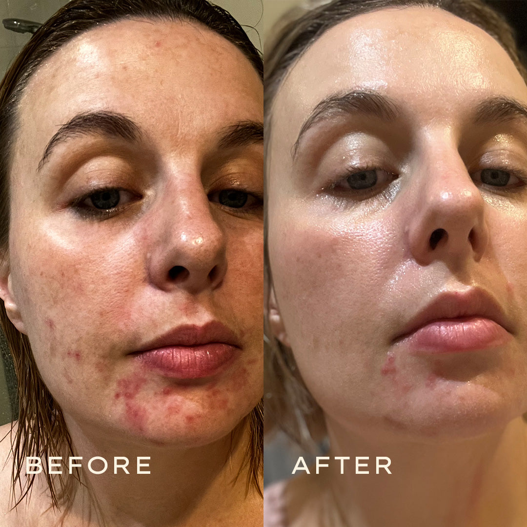 Calendula2025_11_Before  After 1080x1080 Cream 2jpg